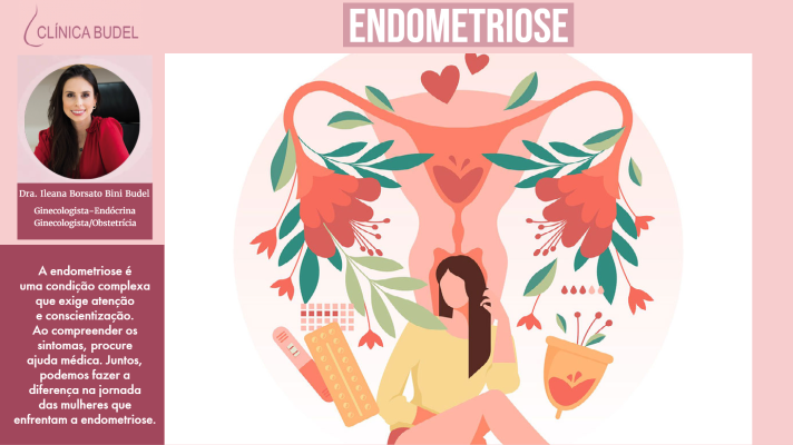 A mulher com Endometriose pode menstruar? - Humanize Diagnósticos