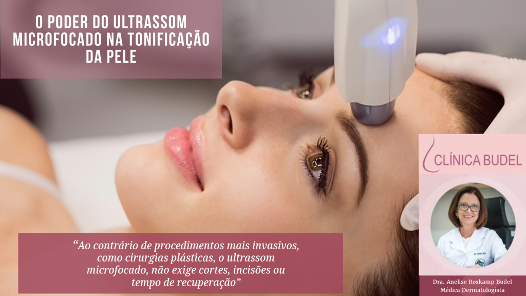 O Poder Do Ultrassom Microfocado Na Tonificação Da Pele Clínica Budel